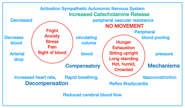 Vasovagal or Vasodepressor Syncope