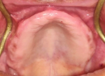 Anatomical Landmarks (Maxillary Arch)