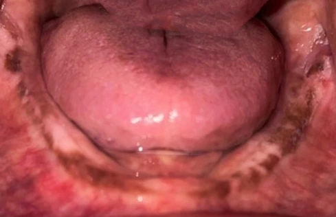 Anatomical Landmarks (Mandibular Arch)