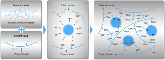 Glass Ionomer Cement (GIC)-old