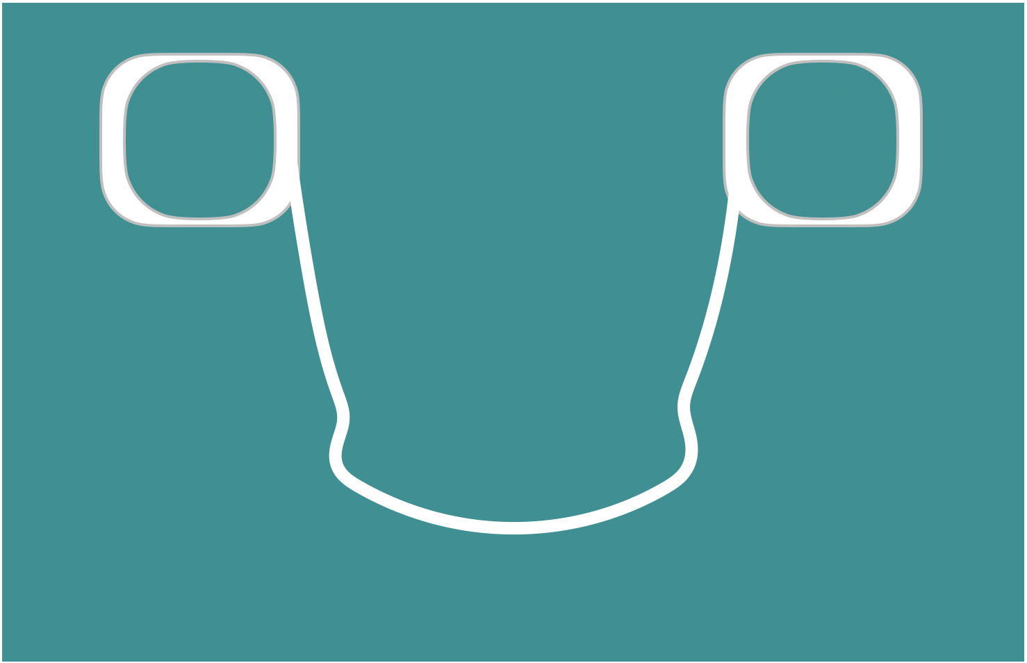 Lingual Arch Space Maintainer