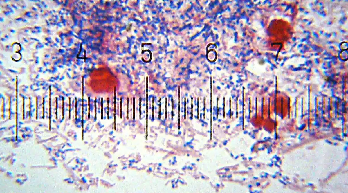 Microbial Flora & Dental Caries