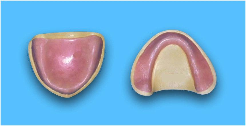 Fabrication of Record Base