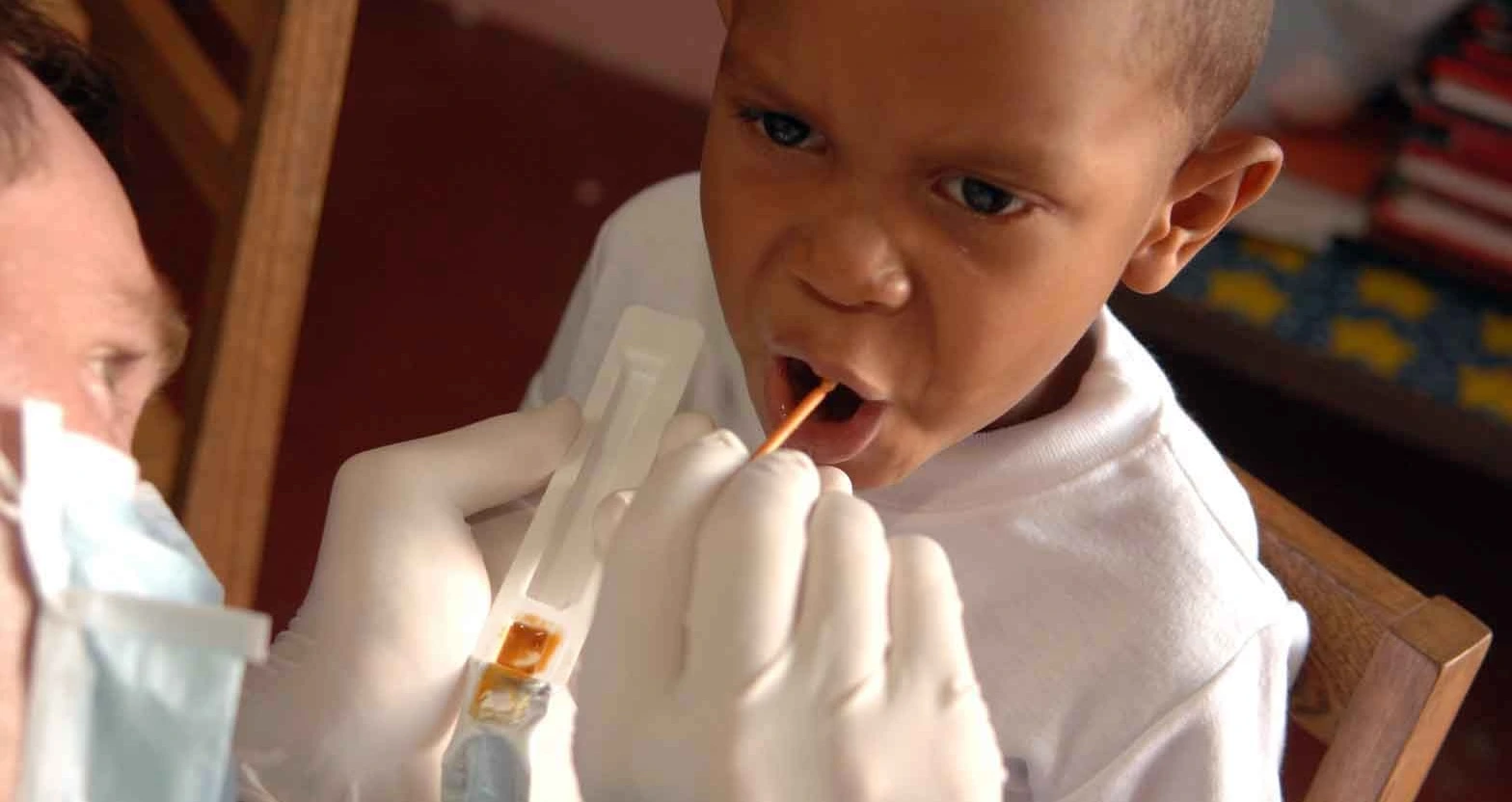 Modes of Fuoride Administration