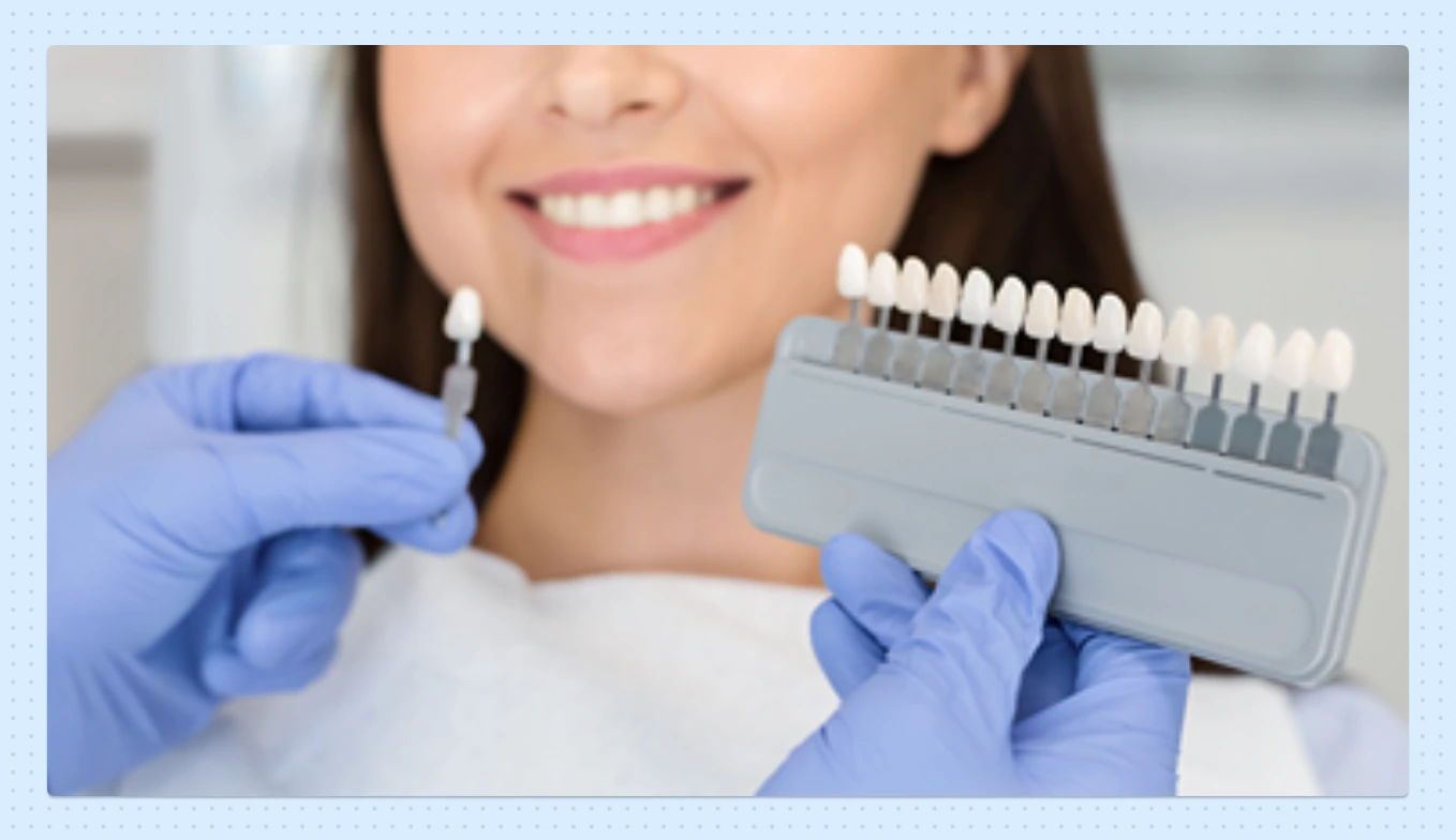 Deciphering the Correct Shade