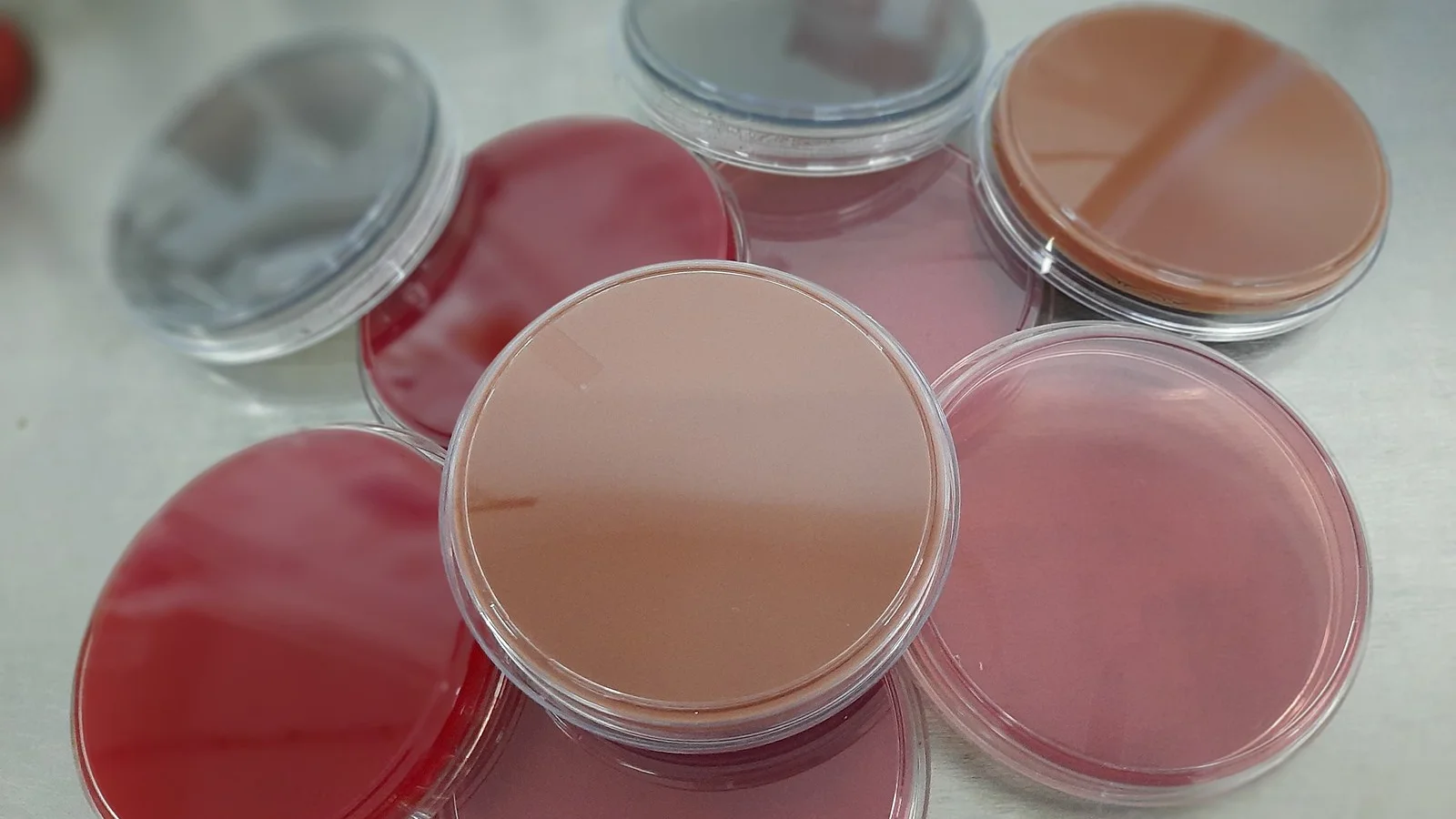 Introduction to Culture Media