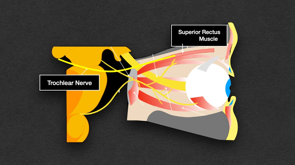 Trochlear Nerve
