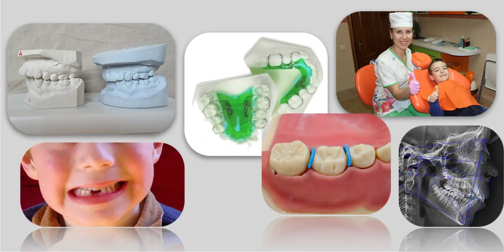 Preventive and Interceptive Orthodontics