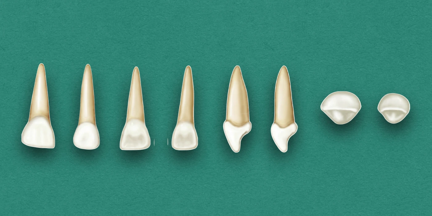 Primary Maxillary Incisors
