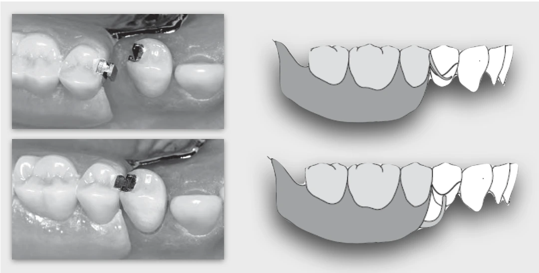 Introduction & Types