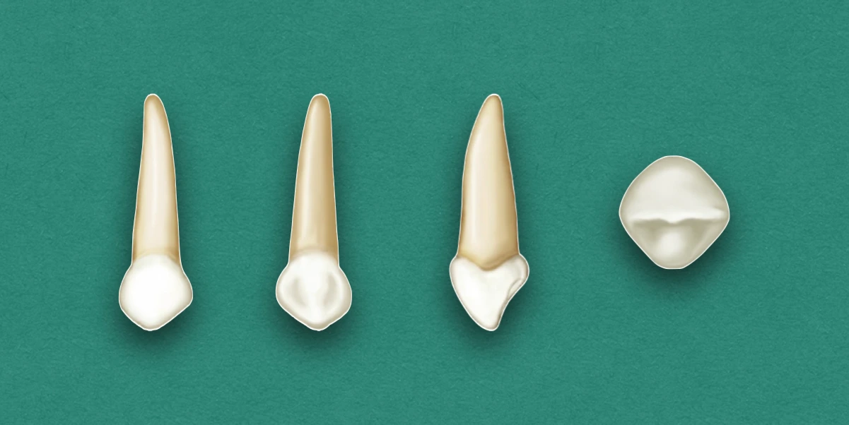 Primary Maxillary Canine