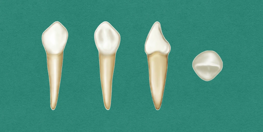 Primary Mandibular Canine