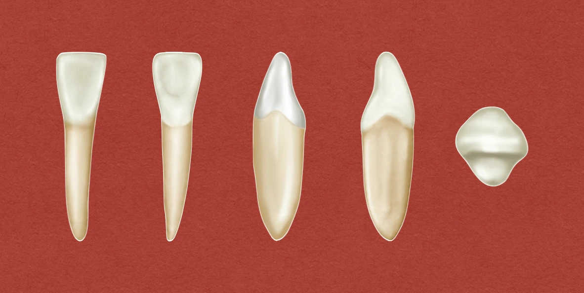 Permanent Mandibular Lateral Incisor