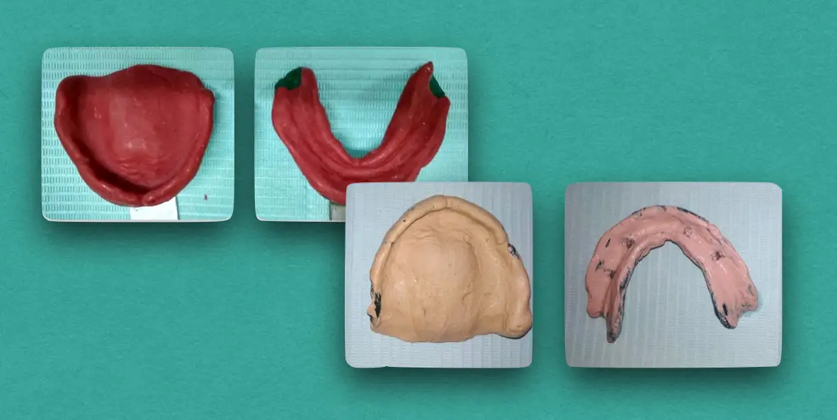 Introduction to Impressions