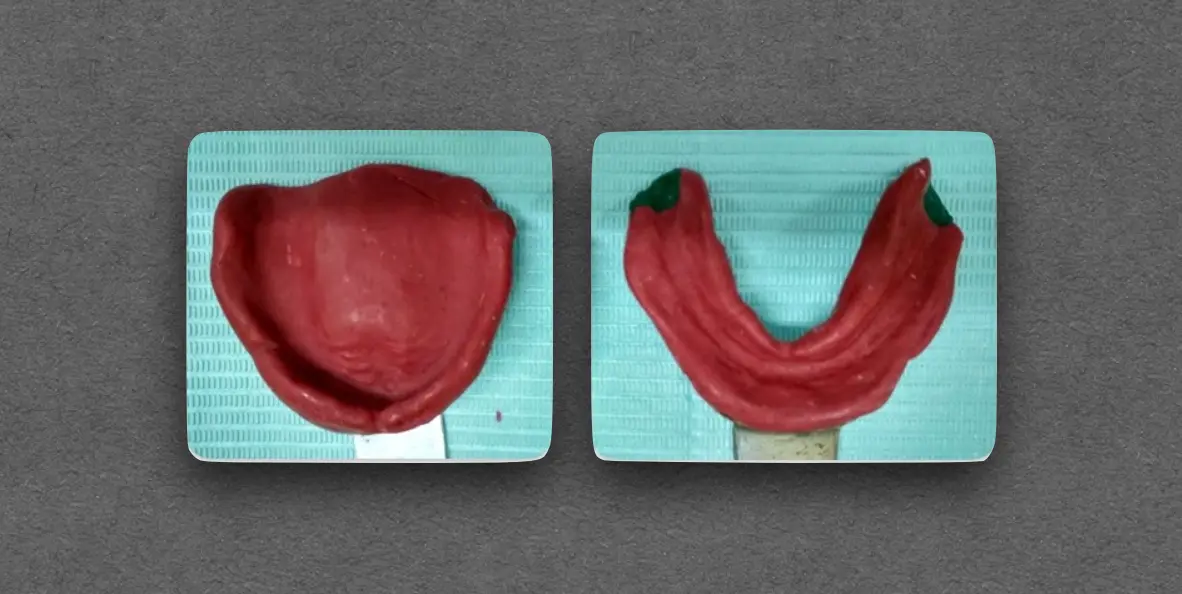 Preliminary Impression