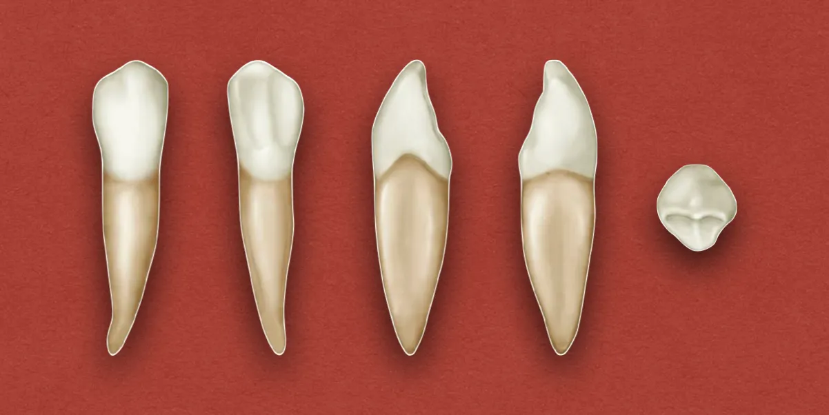 Permanent Mandibular Canine