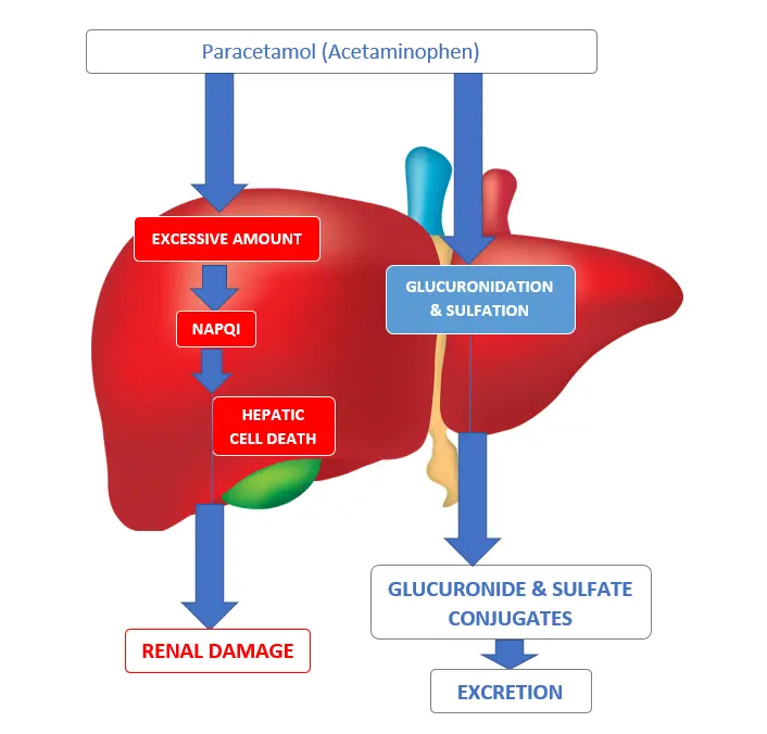 Acute Paracetamol Poisoning